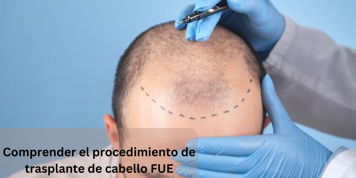 Comprender el procedimiento de trasplante de cabello FUE